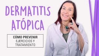 Dermatitis Atópica  Cómo Curar la Piel Atópica [upl. by Naesar]