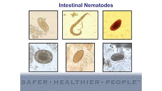 Hookworm Causes Signs and Symptoms Diagnosis and Treatment [upl. by Meihar]