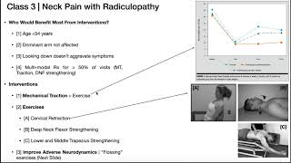 Neck Pain with Cervical Radiculopathy  Presentation  Treatment [upl. by Choo]