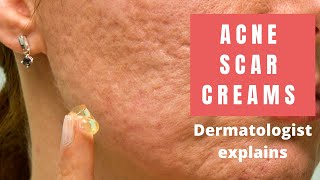 Acne Scar Creams  Dermatologist Reviews [upl. by Benedetta]