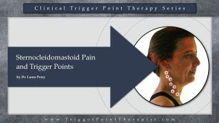 Sternocleidomastoid SCM Pain and Trigger Points [upl. by Eselahs]