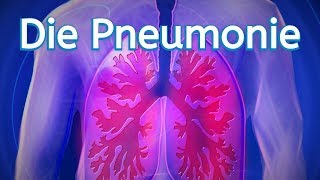 Die Pneumonie [upl. by Danette]