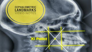 Cephalometric Landmarks and their definition [upl. by Ddene]