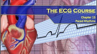 The ECG Course  Paced Rhythms [upl. by Fidole]