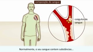 Trombose  Causa e tratamento [upl. by Ibib]