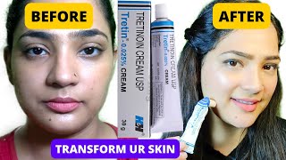 I Used Tretinoin for 1 Year and THIS happened  Tretinoin Update Pm Skin Care Routine with retinA [upl. by Ellecrad]