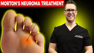 11 BEST Mortons Neuroma Massage Exercise amp Stretch Treatments WOW [upl. by Hcone689]