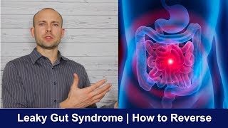 Heal Leaky Gut Naturally  Its Easier Than You Think [upl. by Ahsoj]