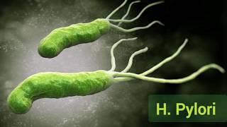 What is a H Pylori Helicobacter Pylori Infection [upl. by Gunas]