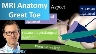 Great toe MRI Anatomy  First metatarsophalangeal joint [upl. by Paulina]