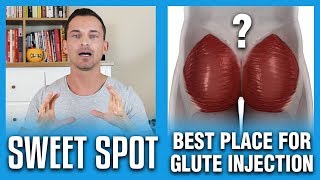 Best Place For Glute Injection  The Sweet Spot [upl. by Adnilema]