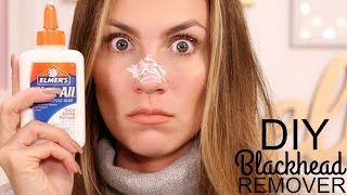 TESTED Glue Nose Strip Beauty Hack  Pinterest DIY Blackhead Remover  Angela Lanter [upl. by Asenad]