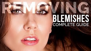 Complete Guide to Removing Blemishes in Photoshop [upl. by Ck818]