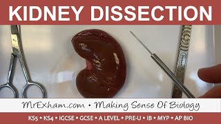 Kidney Dissection  GCSE A Level IB [upl. by Nosila]