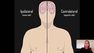 Ipsilateral vs Contralateral [upl. by Akira]