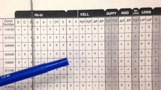 Blood Bank Antibody Panel Overview [upl. by Olgnaed103]