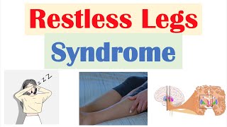 Restless Legs Syndrome RLS  Causes Signs amp Symptoms Diagnosis Treatment [upl. by Weirick]