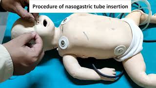 How to place an NG tube in a baby plus some helpful tips [upl. by Annairb]