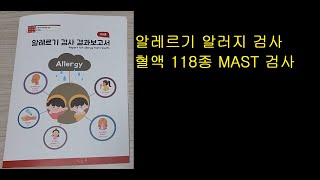 알레르기 알러지 검사 혈액 118종 MAST 검사 [upl. by Atikahs502]