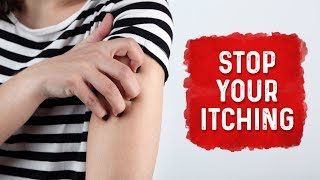 What Causes Hives and Itchiness  Urticaria Hives Treatment  Dr Berg [upl. by Marola]