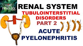 ACUTE PYELONEPHRITIS Pathology [upl. by Levinson]