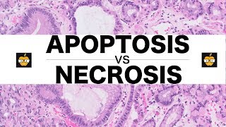 Apoptosis Intrinsic Extrinsic Pathways vs Necrosis [upl. by Hosbein]