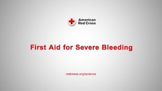 First Aid for Severe Bleeding [upl. by Rupert203]