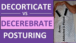 Decerebrate vs Decorticate Posturing Rigidity Mnemonic amp Pictures Nursing NCLEX [upl. by Bobette]