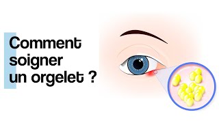 Comment soigner un orgelet [upl. by Enilekcaj969]