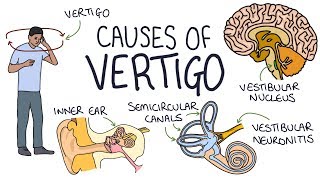 Labyrinthitis and Vertigo BPPV Hazels story  NHS [upl. by Mervin]