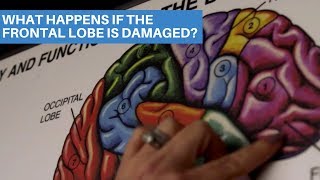 What Happens If The Frontal Lobe Is Damaged [upl. by Orion]