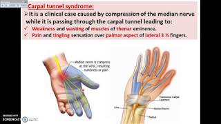 Overview of UL 14  Deep Fascia of Palm of the Hand  Dr Ahmed Farid [upl. by Rimhsak220]