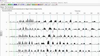 SeisImager2D Seismic Refraction data processing [upl. by Rosaline581]