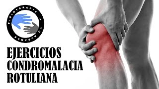 Ejercicios para condromalacia rotuliana o patelar [upl. by Ramo]