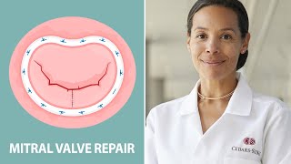 Mitral Valve Repair Different Approaches for Different Patients Interview with Dr Joanna Chikwe [upl. by Nitas]