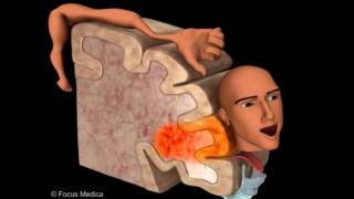 Primary Motor Cortex  Neuroanatomy [upl. by Vange]