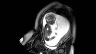 Foetal Development Unborn Baby Movement at 24 Weeks  WIRED [upl. by Chadd632]