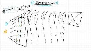 Ultraschall  Sonographie [upl. by Madelaine]