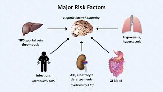 Hepatic Encephalopathy [upl. by Hannus332]