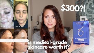 MY SKINCARE ROUTINE ZO SKIN HEALTH REVIEW AND 1 MONTH RESULTS  is medicalgrade worth the money [upl. by Robaina]