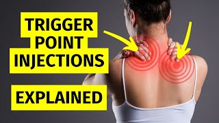 Myofascial Pain Trigger Point Injections Explained [upl. by Natala880]