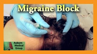 The cuttingedge treatments for migraines l GMA [upl. by Layney514]