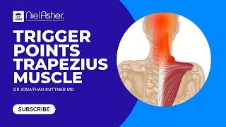 Trapezius  How To Find Trigger Points [upl. by Marcy]