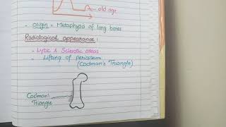 Osteosarcoma Pathology [upl. by Minnie]