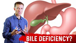 How To Know if You Have Bile Deficiency  Dr Berg [upl. by Annasor]