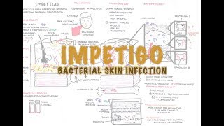 Impetigo Bacterial Skin Infection  Overview Clinical Presentation Pathophysiology Treatment [upl. by Noyart514]