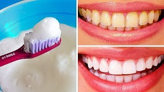 10 Maneiras Naturais de Clarear seus Dentes em Casa [upl. by Mairym854]