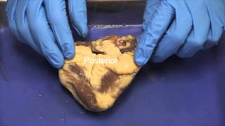 NAU BIo 202 Lab 3  Sheep Heart Dissection [upl. by Sabec]