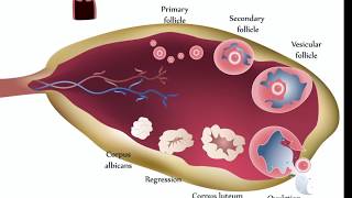 Ovarian Cysts [upl. by Mitran]