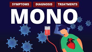 What is MONO Symptoms Diagnosis amp Treatments [upl. by Sklar808]